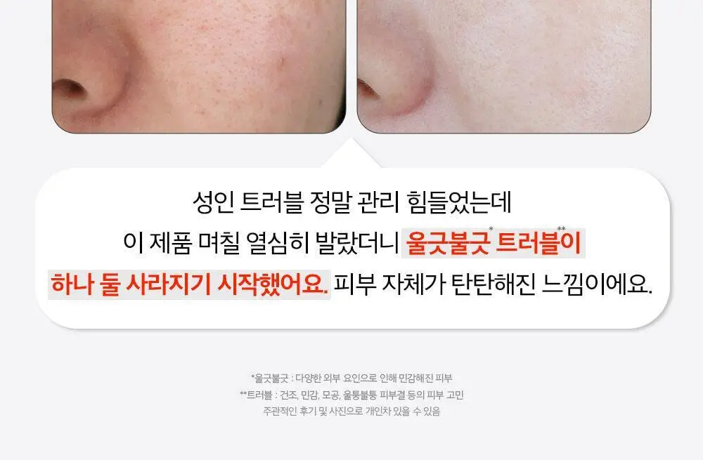 피부미 센텔루션 시카 크림 3X 100ml [건성] 상세페이지 2